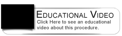 Dental Education Video - Single Visit Whitening